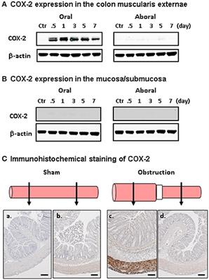 Mechanical Regulation of Gene Expression in Gut Smooth Muscle Cells